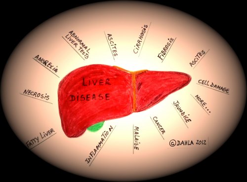 liver-diagram
